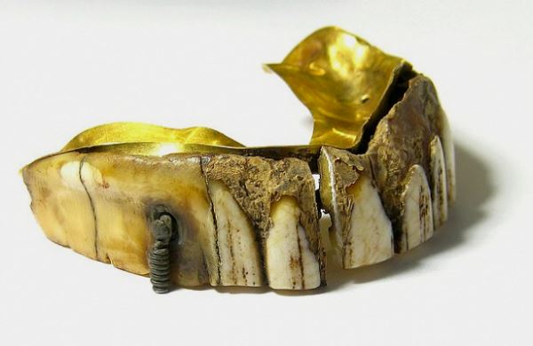 <br />
Найдена 200-летняя вставная челюсть из золота и кости<br />
